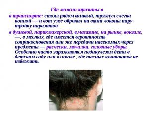 Где можно заразиться в транспорте: стоял рядом вшивый, тряхнул слегка копной — и