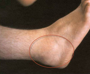 Голеностопный сустав