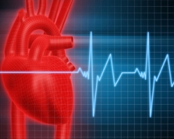 Ишемическая болезнь сердца 