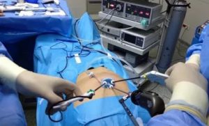 Температура после удаления желчного пузыря