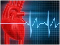 Тахикардия