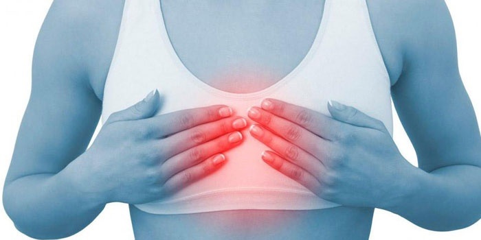 Температура при межреберной невралгии